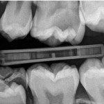 Figure 10 Images with Solid State Detectors can be smaller than equivalent film or PSPs