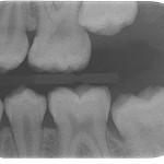 Figure 7 “Greying out”