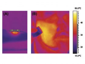 FIGURE 4: In vivo thermal view showing the initial application of Forma handpiece (A) and following treatment, a uniform heat distribution at 43°C across an entire right cheek (B).