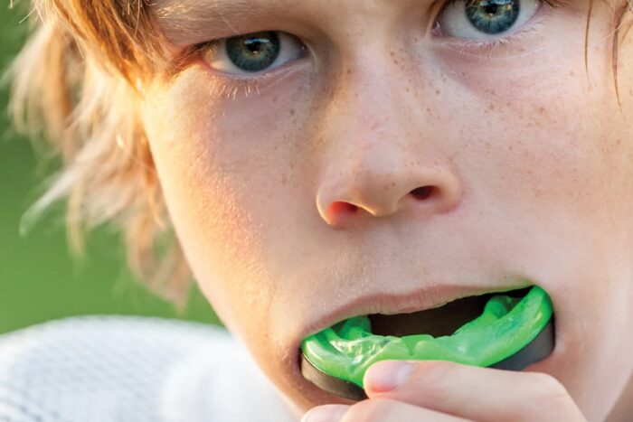 A close up on a kid inserting his sports mouthguard.